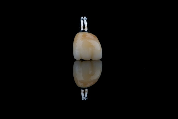Dental Crowns